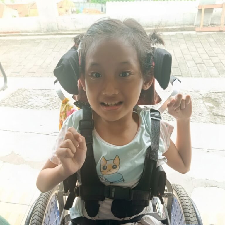 Santunan Berobat Afifah Nayla, Anak 9 Tahun dengan Gangguan Motorik